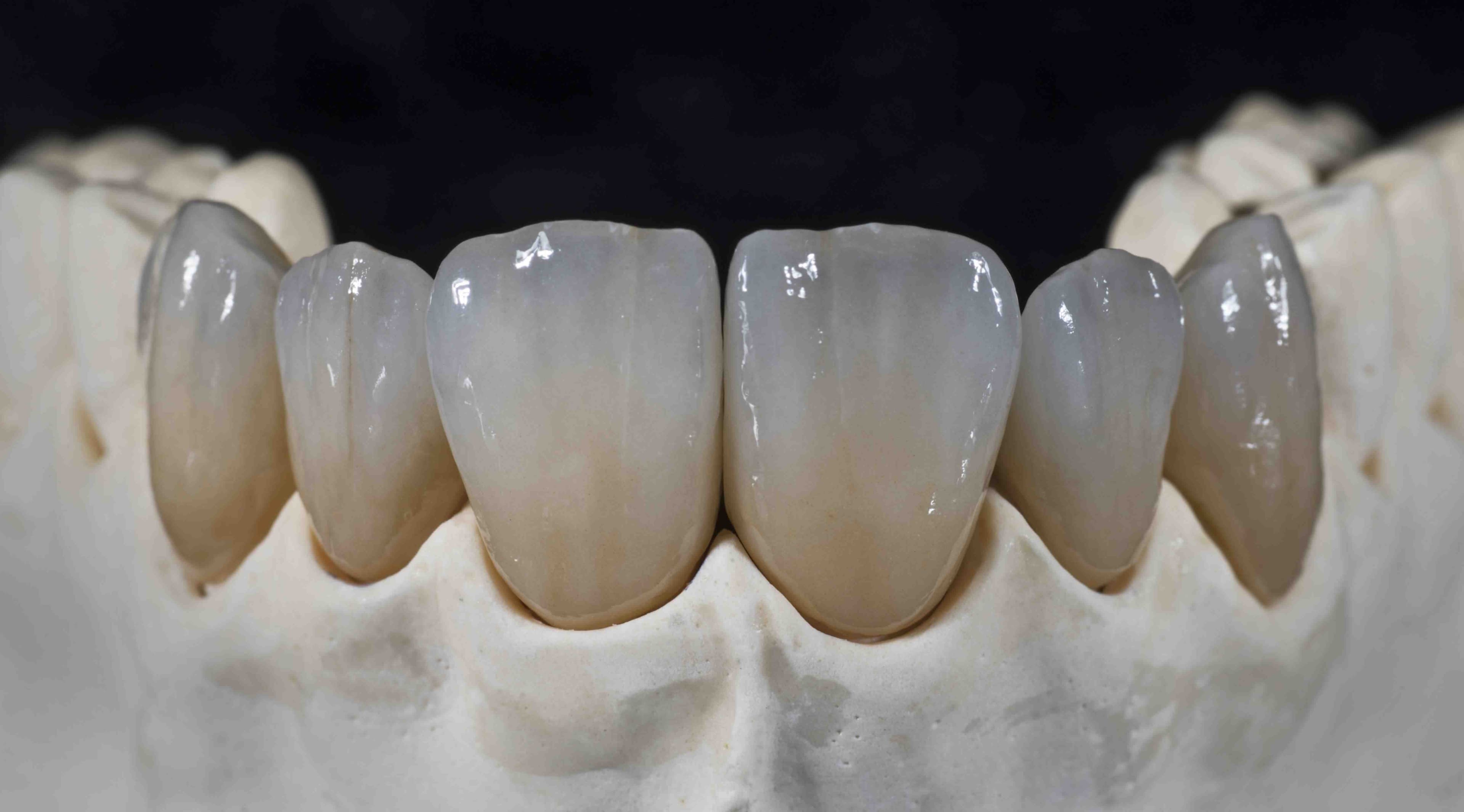 Treatment planning case